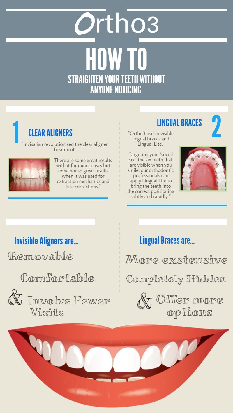 When Should You Straighten Your Teeth? - Aperture Dental Practice