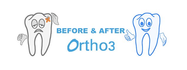 Nothing like visual results – before and after photos of orthodontics