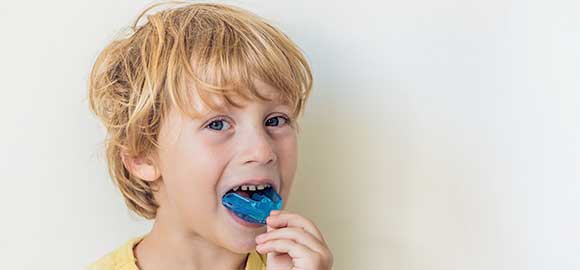 Braces and Mouthguards